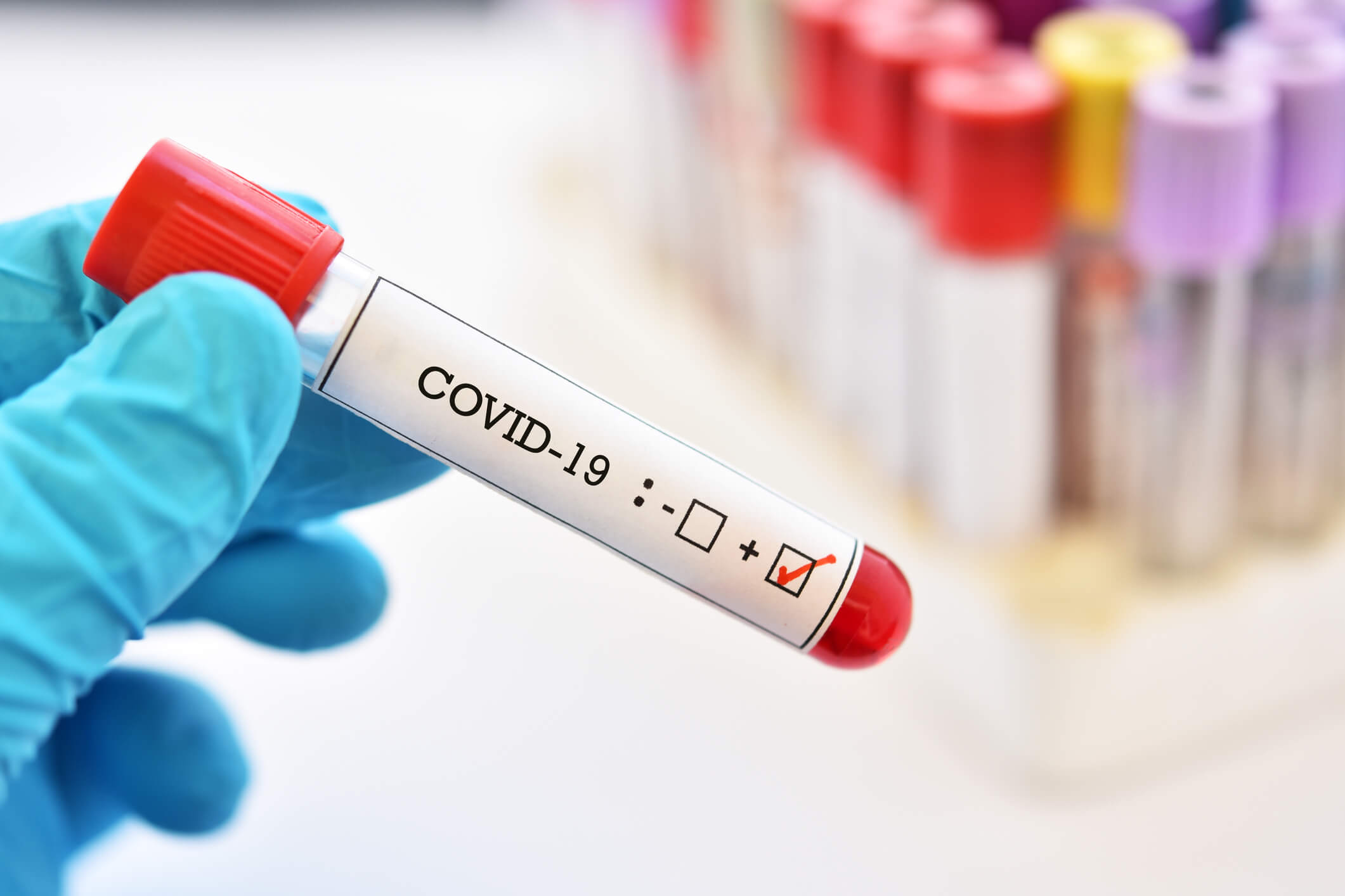 Épidémie de COVID19 : ne plus réaliser de TROD angine à l'officine